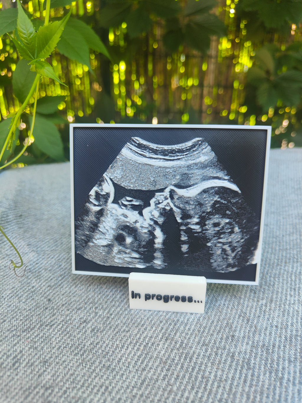 Échographie 3D personnalisée avec support – Annonce grossesse & souvenir bébé