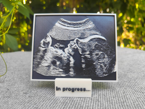 Échographie 3D personnalisée avec support – Annonce grossesse & souvenir bébé