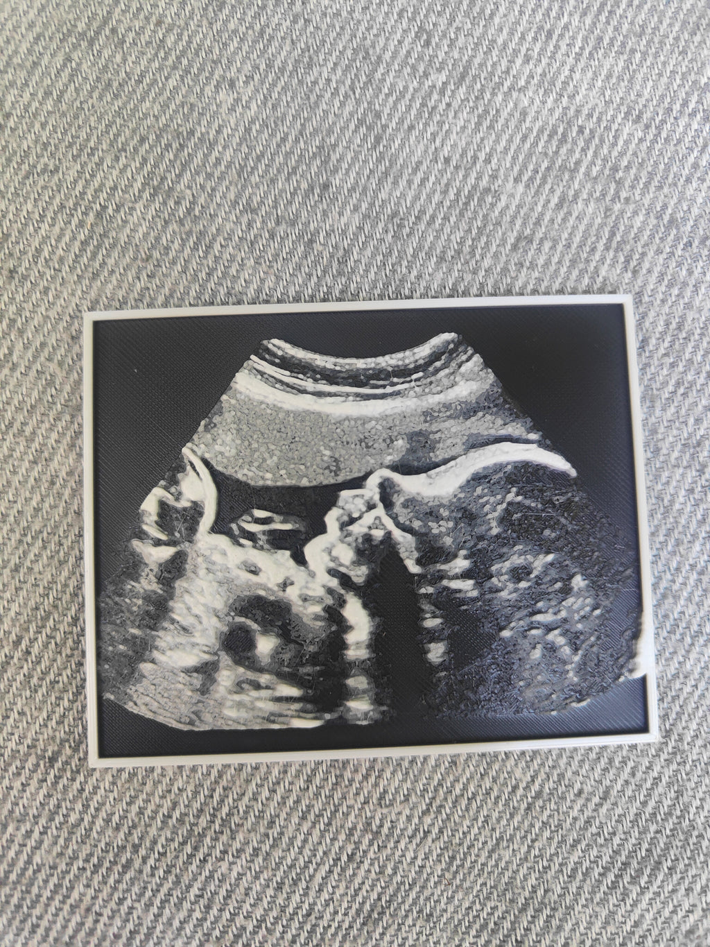 Échographie 3D personnalisée avec support – Annonce grossesse & souvenir bébé